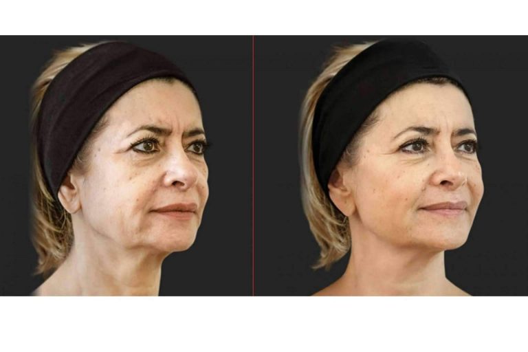 La clínica de la Dra. Beatriz Sánchez Peral ayuda a prevenir los signos de la edad