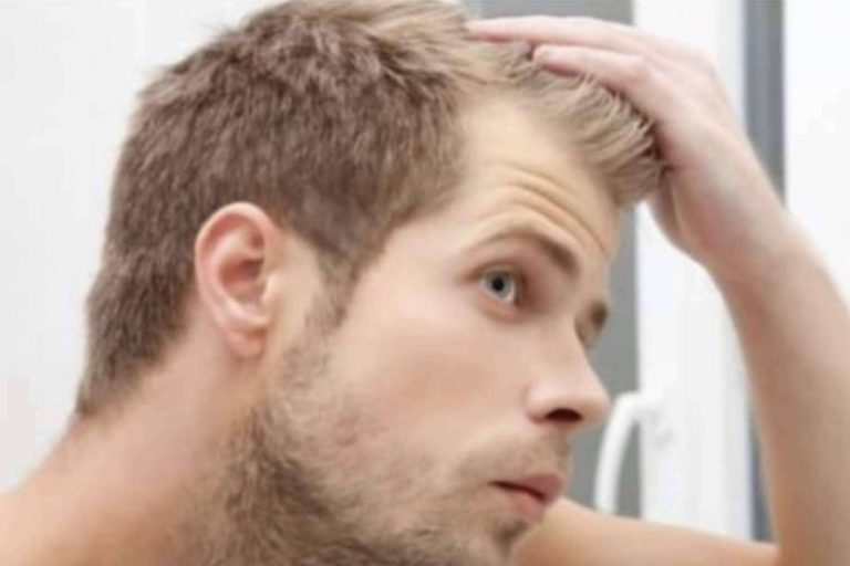 Wiotech España ofrece un tratamiento pre y post implante capilar