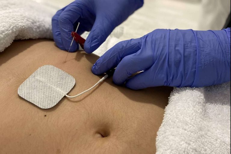 Perder 10 kg en dos meses sin sensación de hambre con la ayuda de Neuroline T6