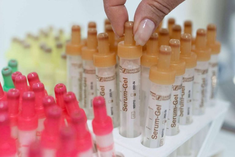 La Clínica MAGNETOSUR realiza test de antígenos con QR de la UE