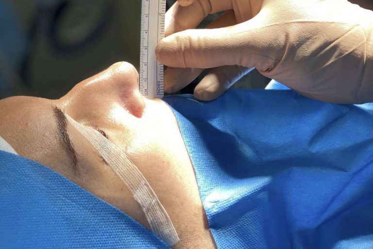 Uno de los cirujanos estéticos mejor valorados en Madrid, el Dr. Roy Camacho