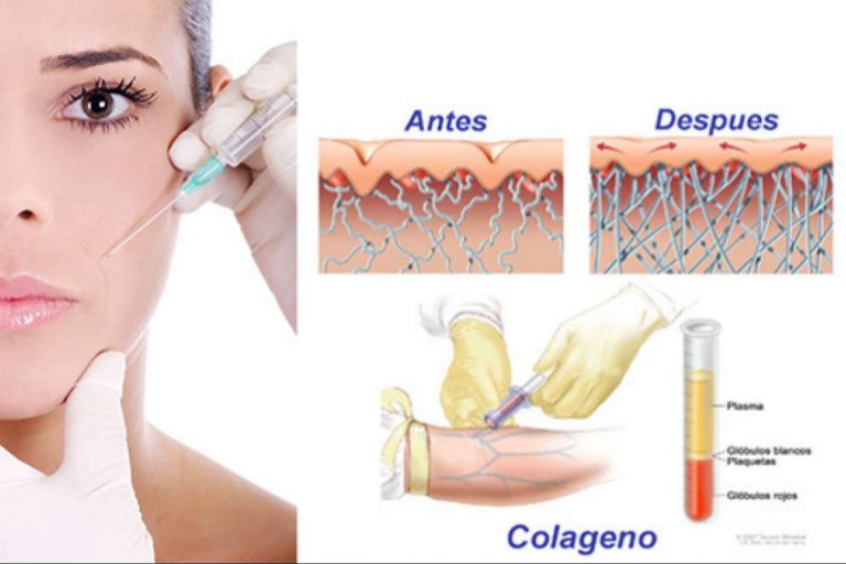 KōAN Club ayuda a combatir los signos de envejecimiento mediante el PRP facial