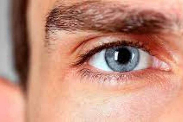 En Occidente, la segunda causa de ceguera es el glaucoma