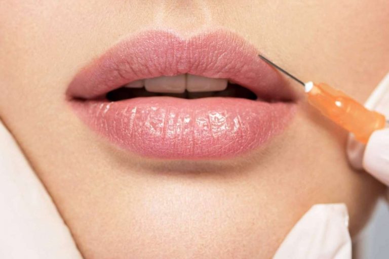 Mesoterapia facial, un tratamiento para combatir el envejecimiento de la piel