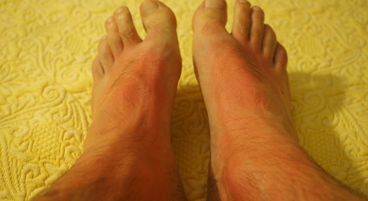 Los desconocidos peligros que se esconden en tu hogar