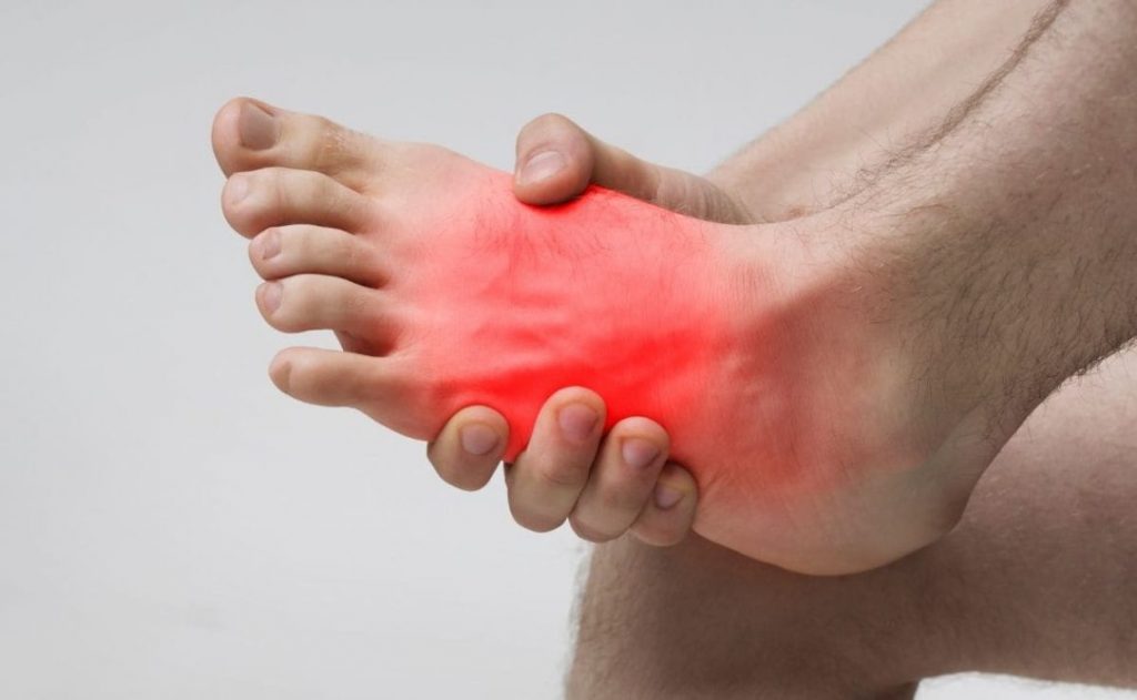 Qué no comer si tienes el ácido úrico alto