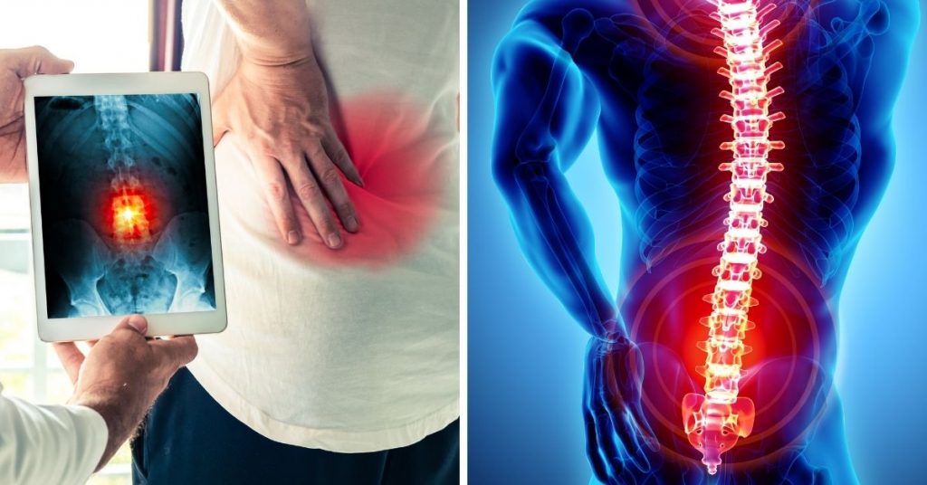 Qué es el hueso palomo 60 ¿El hueso palomo de quienes es propio?