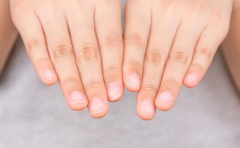 Razones por las que tus uñas no crecen rápido y se te rompen