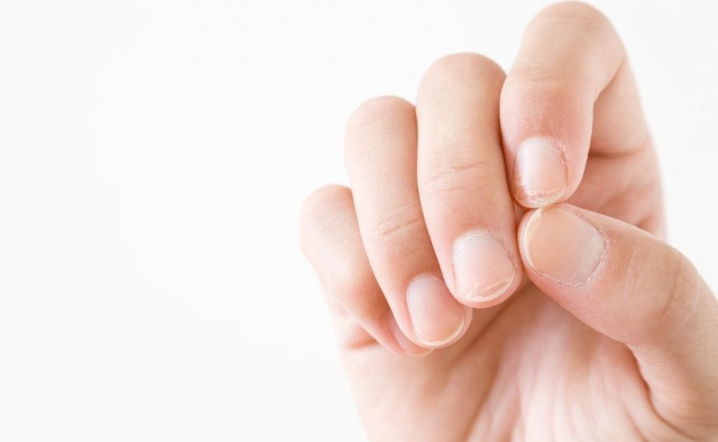 ¿Qué es lo que pasa con la uñas de los pies?