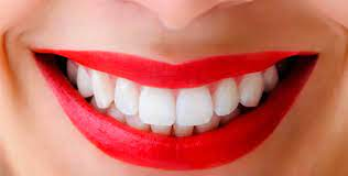 Dientes blancos: alimentos que blanquean tus dientes rápidamente