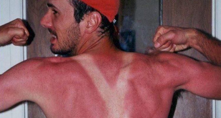 Locos que no le tienen miedo al sol