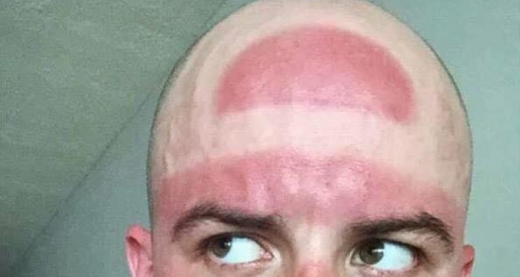 Locos que no le tienen miedo al sol