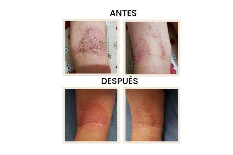 Revolución en la dermocosmética natural con el pack de Green Cornerss