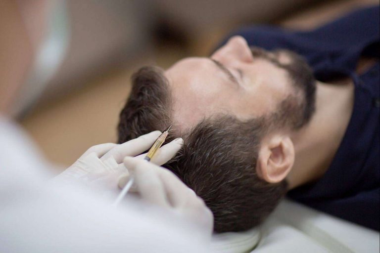 El plasma rico en plaquetas y dutasterida es una potente terapia regenerativa de doble efecto contra la caída del cabello