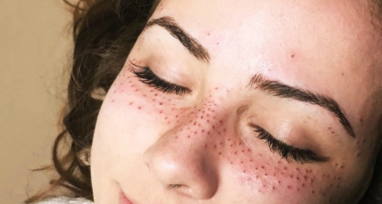 Extensiones de pelo en la nariz y otras modas absurdas de Instagram 2 Extensiones de pelo en la nariz y otras modas absurdas de Instagram