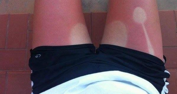 Locos que no le tienen miedo al sol