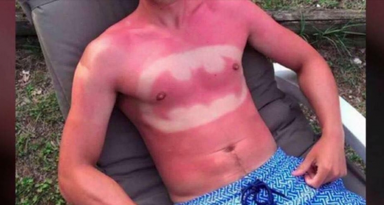 Locos que no le tienen miedo al sol