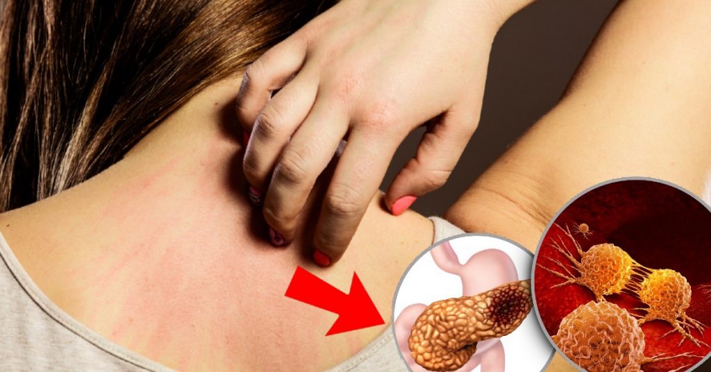 Atención a esta recomendación