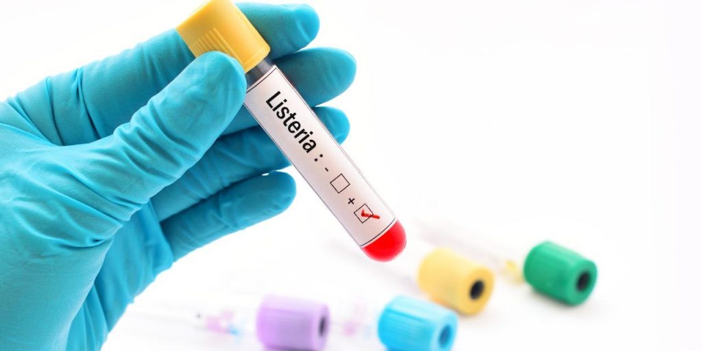 ¿Cómo se diagnostica la Listeria?