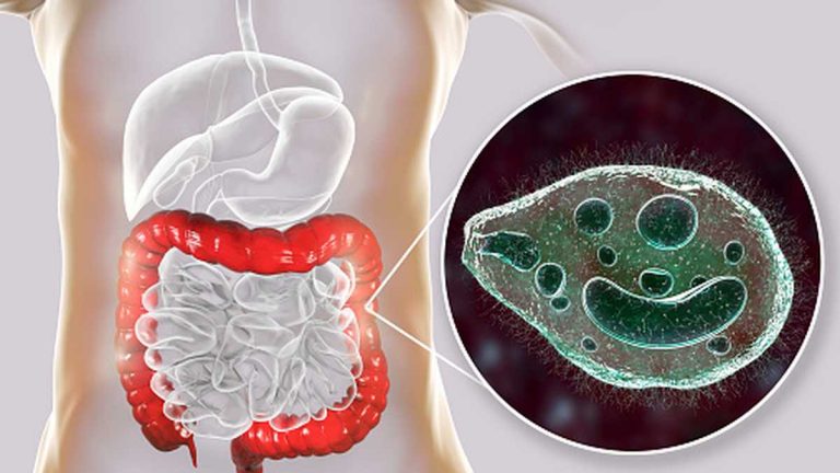 Las razones por las que deberías 'desparasitar' tu cuerpo