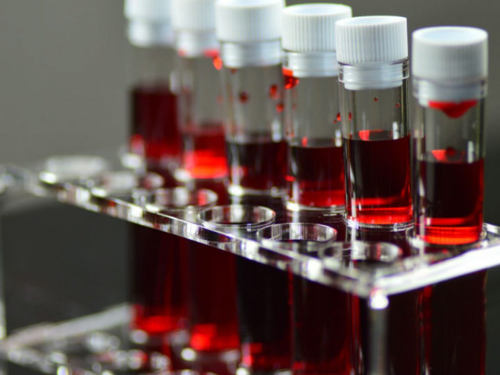 ¿Cómo se detectan los antígenos del Rh?