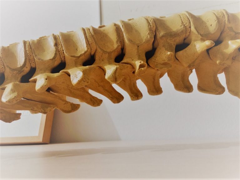 Tumores en reloj de arena: descubre cómo se trata este tipo de cáncer raro en la columna vertebral