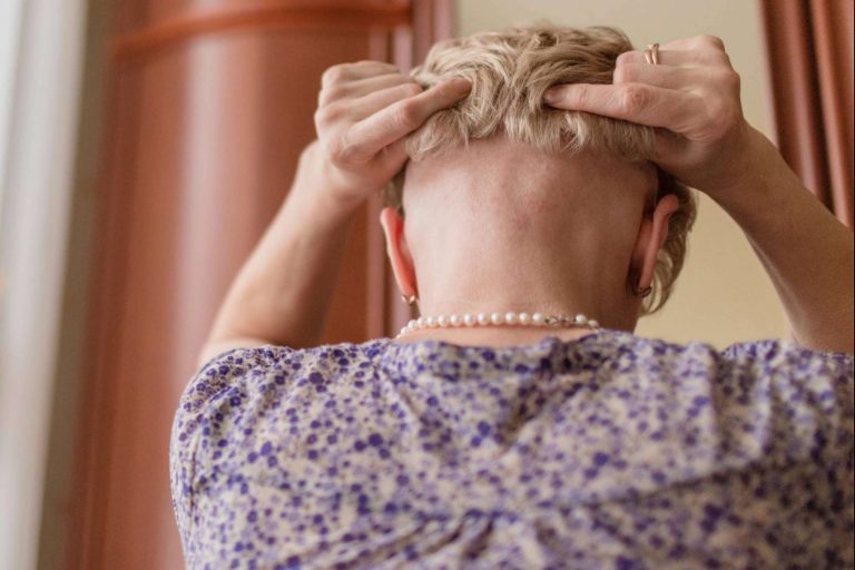 La alternativa a la pérdida de cabello, prótesis capilares
