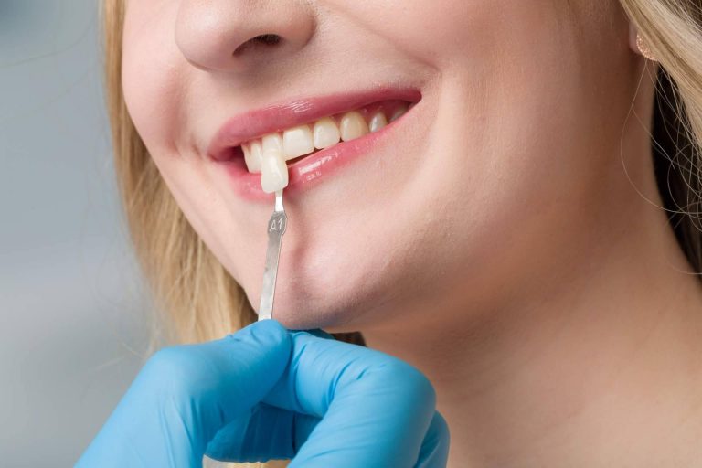 El tratamiento de carillas dentales se lleva a cabo en esta clínica dental de Chamartín
