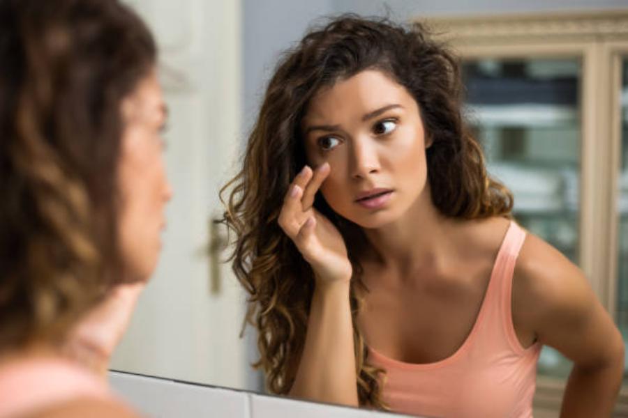 Las ojeras hacen lucir el rostro cansado
