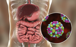 Gastroenteritis en verano: el digestivo Gerardo Blanco alerta de los errores que cometes al tratarla