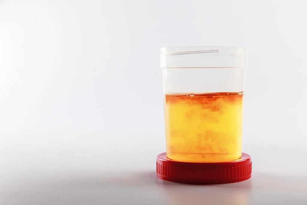 sangre en orina bote