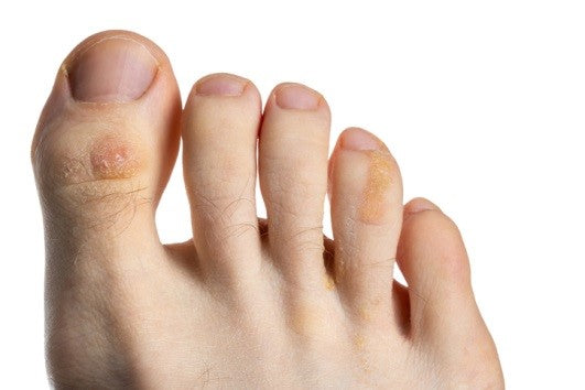 No estrenes zapatos cuando vayas a pasear