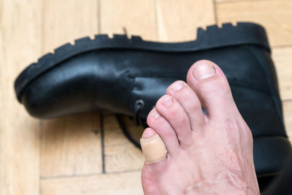 ¿Cómo prevenir la aparición de ampollas?