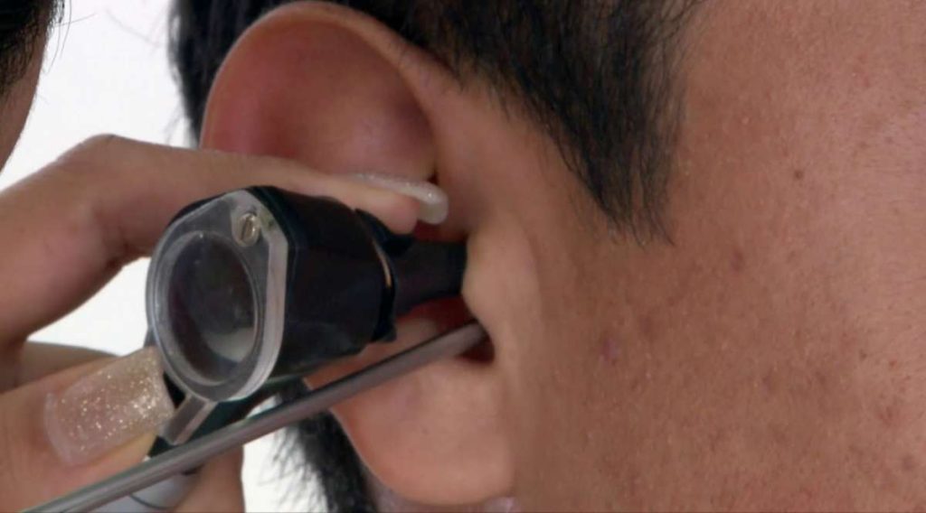 Ni velas ni hisopos, la microsucción