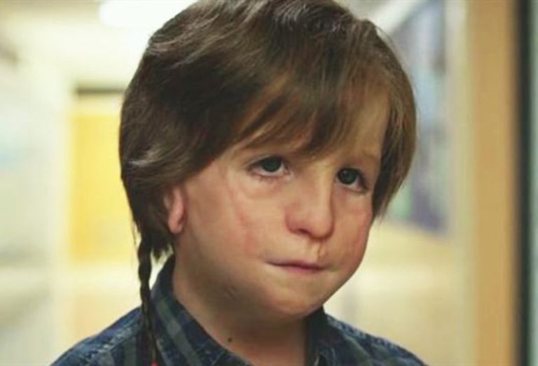 Así está ahora el protagonista de Wonder