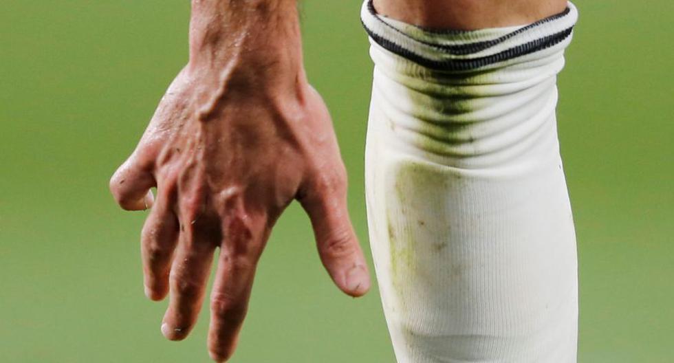 La deformación que tiene Benzema y que no te habías dado cuenta 69 ¿En qué condiciones está el dedo de Benzema?