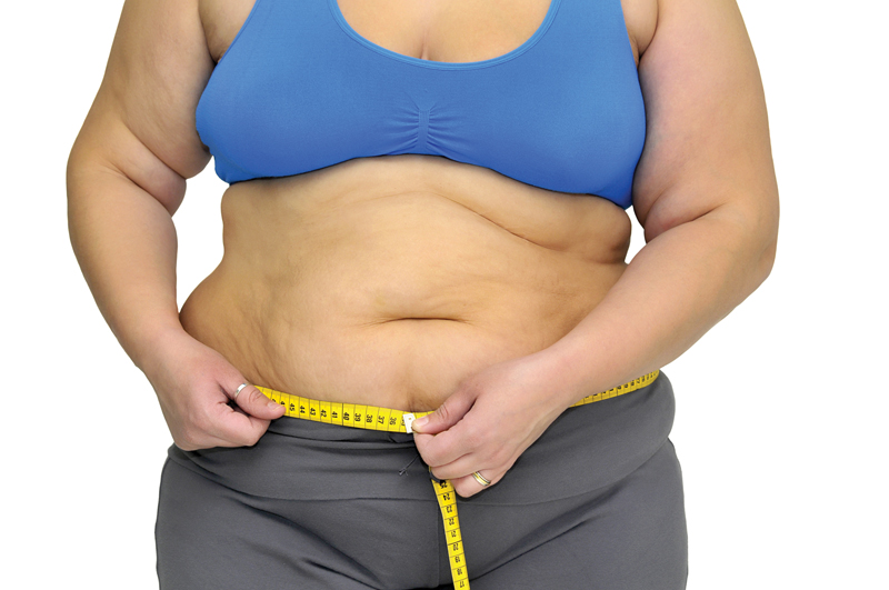 ¿Qué es la obesidad?