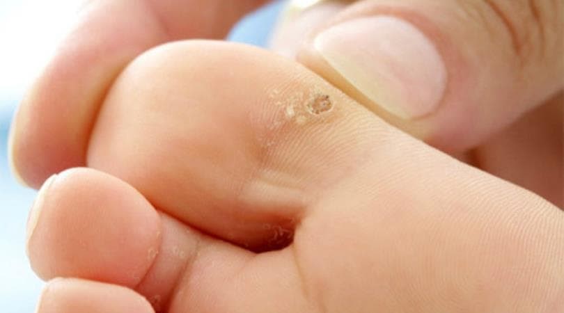 Te pueden hacer una cirugía