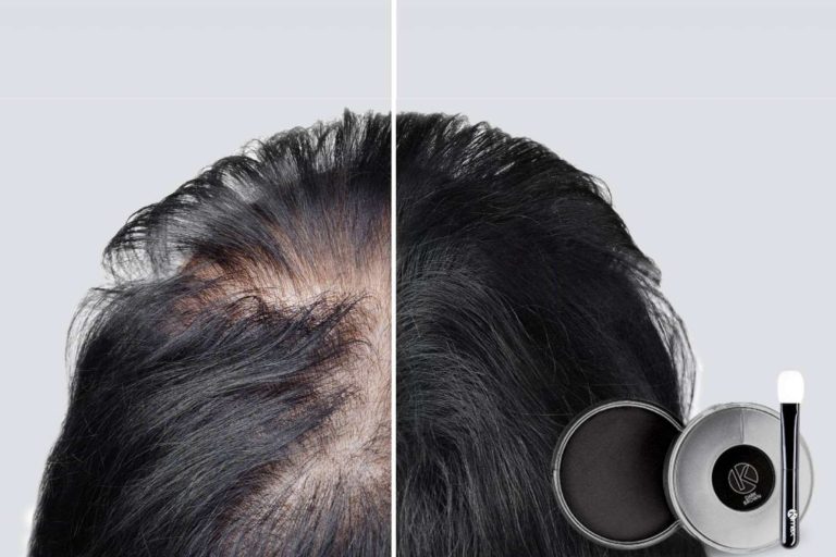 Ocultar los primeros signos de la alopecia con el maquillaje capilar