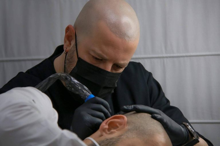 Cuáles son los beneficios de la micropigmentación capilar que realiza INBLAK