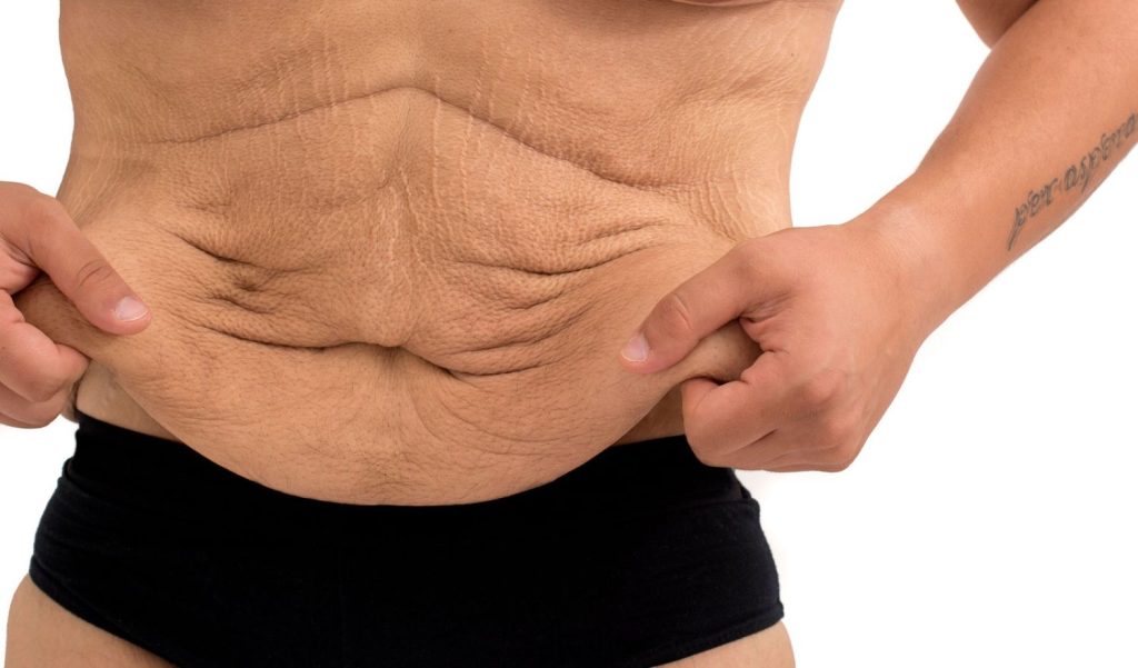 No salen únicamente por causa del embarazo