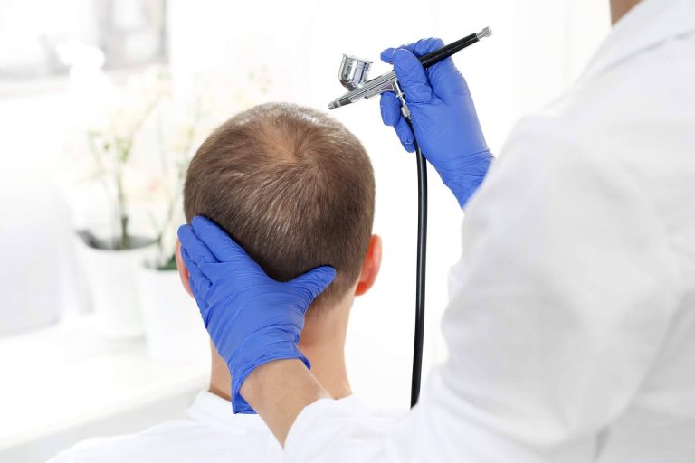 Crina Rus Beauty Center sobre la oxigenoterapia capilar