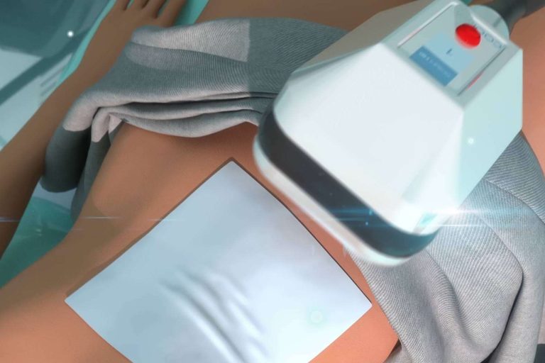 Pixel Dreams sigue creciendo en el sector de la animación 3D con su último proyecto para la firma médica Cocoon Medical