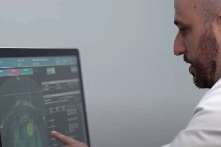 Biopsia fusión y resonancia magnética, la evolución del diagnóstico del cáncer de próstata