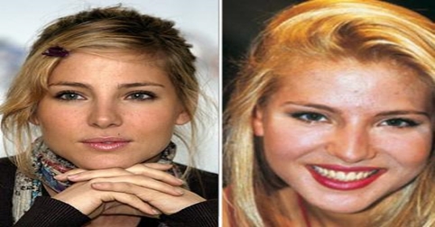 Famosas a las que operarse les sentó bien