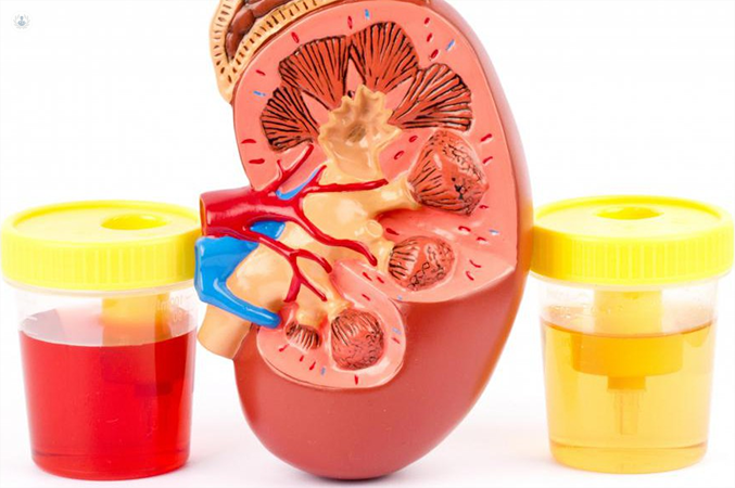 Síntomas que te avisan de que los riñones no te funcionan bien 134 El síntoma que indica mal funcionamiento de riñones