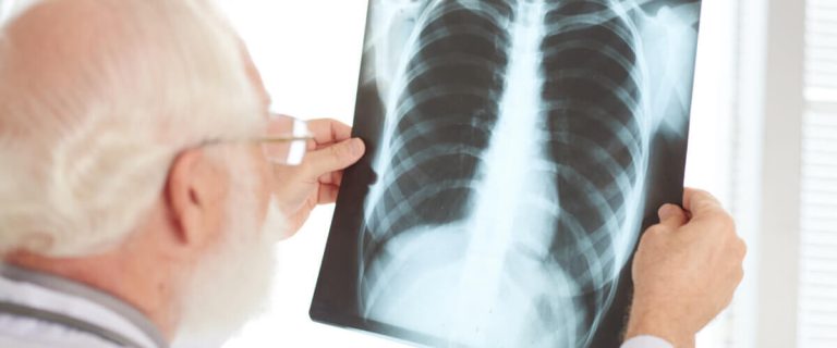 Bronquitis, neumonía, pulmonía te contamos sus diferencias