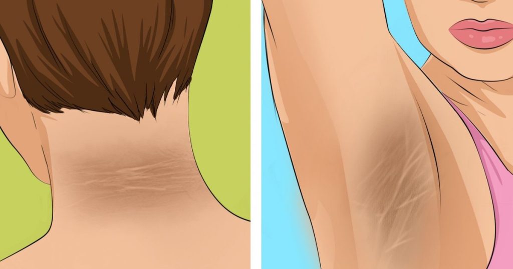 Incremento inusual de la sed