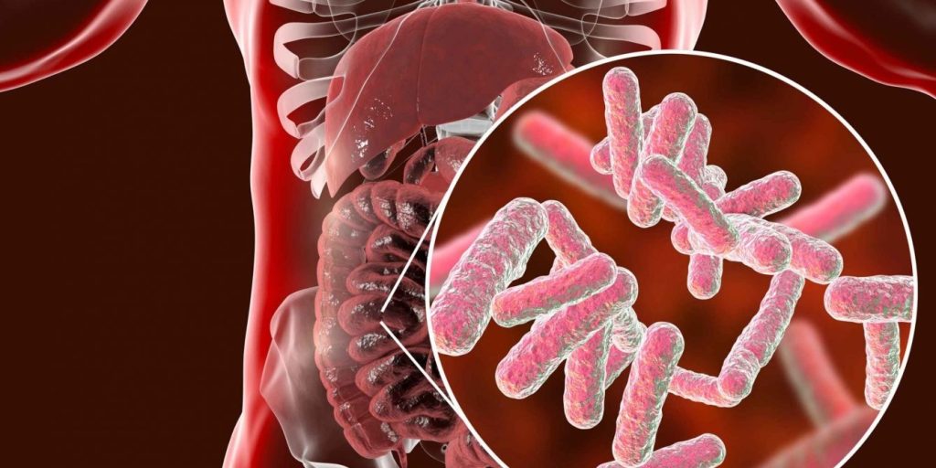 Sobrecrecimiento bacteriano del intestino delgado (SIBO)