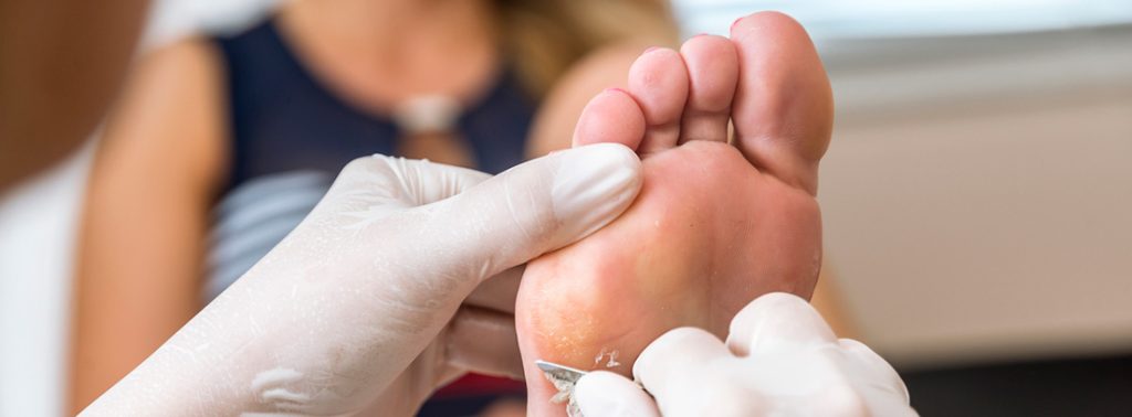 Esto es lo que debes hacer si pisas un clavo en la calle 184 Vacuna contra el tétanos